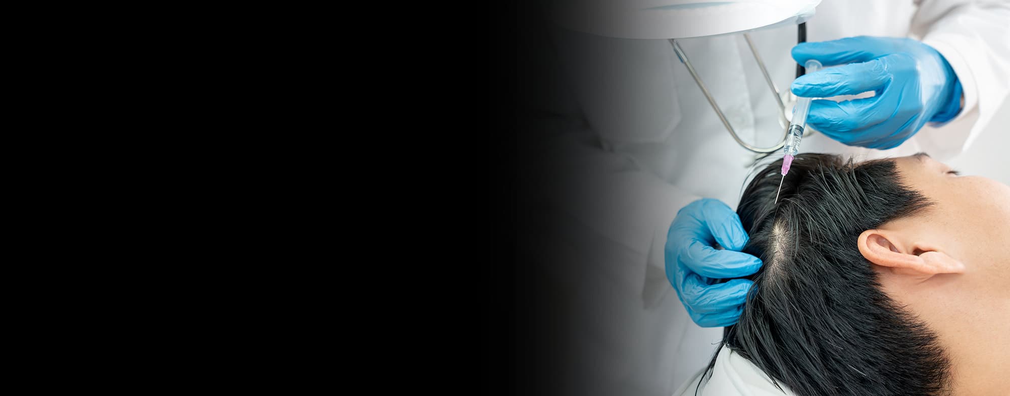 Tratamientos capilares — Dr. Sergio Quintero