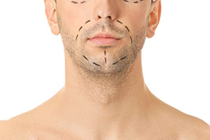 Dr Sergio Quintero masculinización facial